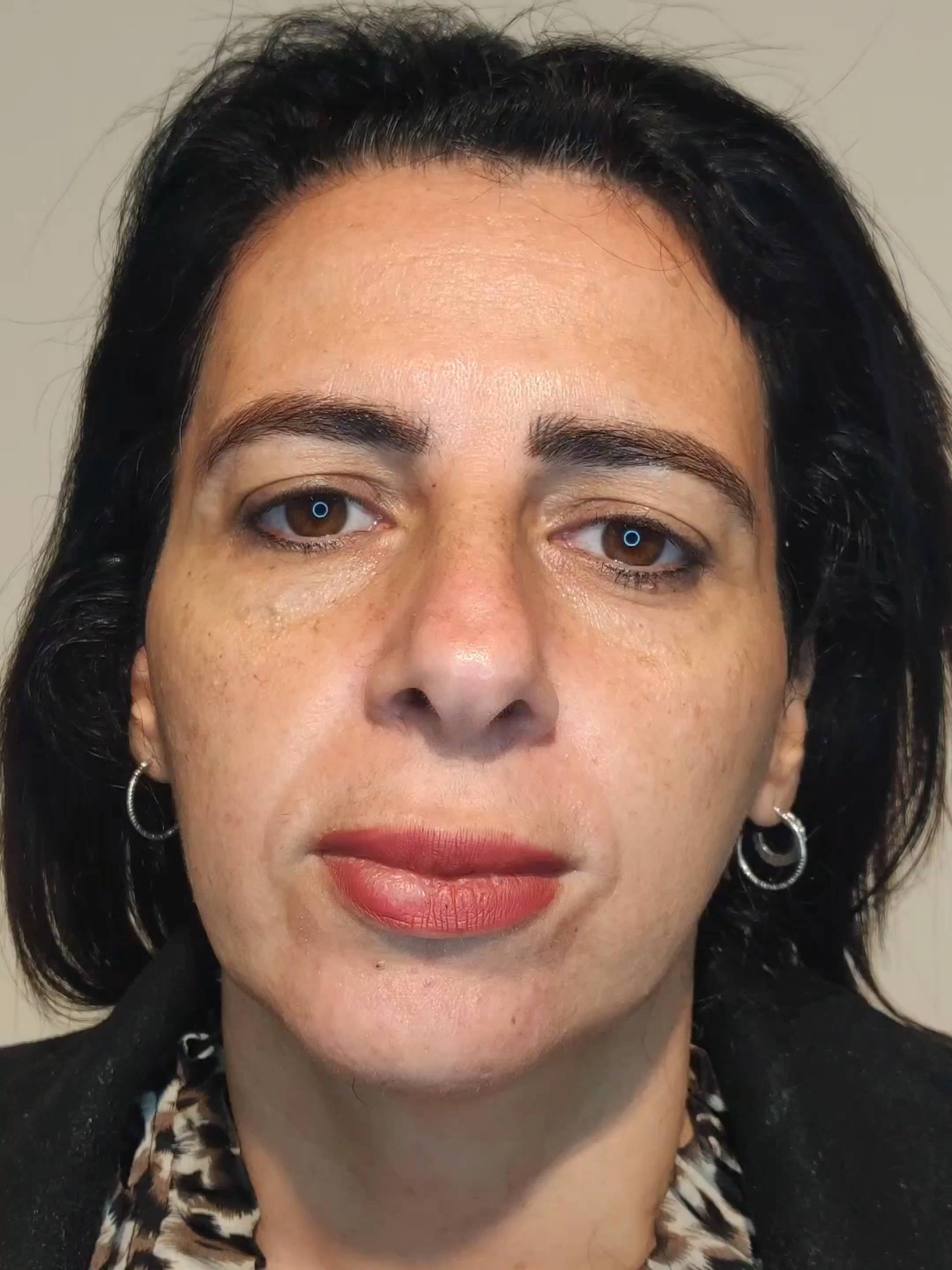 טיפול הערפד